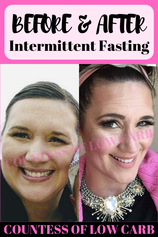before and after intermittent fasting
